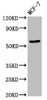 Western Blot<br />
 Positive WB detected in: MCF-7 whole cell lysate<br />
 All lanes: OCLN antibody at 3.2µg/ml<br />
 Secondary<br />
 Goat polyclonal to rabbit IgG at 1/50000 dilution<br />
 Predicted band size: 60, 53, 55, 32, 24, 9 kDa<br />
 Observed band size: 60 kDa<br />