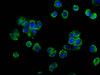 Immunofluorescence staining of MCF-7 cells with CSB-PA016263LA01HU at 1:133, counter-stained with DAPI. The cells were fixed in 4% formaldehyde, permeabilized using 0.2% Triton X-100 and blocked in 10% normal Goat Serum. The cells were then incubated with the antibody overnight at 4°C. The secondary antibody was Alexa Fluor 488-congugated AffiniPure Goat Anti-Rabbit IgG (H+L) .