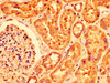 IHC image of CSB-PA018222LA01HU diluted at 1:200 and staining in paraffin-embedded human kidney tissue performed on a Leica BondTM system. After dewaxing and hydration, antigen retrieval was mediated by high pressure in a citrate buffer (pH 6.0) . Section was blocked with 10% normal goat serum 30min at RT. Then primary antibody (1% BSA) was incubated at 4°C overnight. The primary is detected by a biotinylated secondary antibody and visualized using an HRP conjugated SP system.