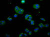 Immunofluorescence staining of HepG2 cells with CSB-PA623281LA01HU at 1:133, counter-stained with DAPI. The cells were fixed in 4% formaldehyde, permeabilized using 0.2% Triton X-100 and blocked in 10% normal Goat Serum. The cells were then incubated with the antibody overnight at 4°C. The secondary antibody was Alexa Fluor 488-congugated AffiniPure Goat Anti-Rabbit IgG (H+L) .