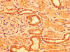 IHC image of CSB-PA768206LA01HU diluted at 1:300 and staining in paraffin-embedded human kidney tissue performed on a Leica BondTM system. After dewaxing and hydration, antigen retrieval was mediated by high pressure in a citrate buffer (pH 6.0) . Section was blocked with 10% normal goat serum 30min at RT. Then primary antibody (1% BSA) was incubated at 4°C overnight. The primary is detected by a biotinylated secondary antibody and visualized using an HRP conjugated SP system.