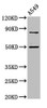 Western Blot<br />
 Positive WB detected in: A549 whole cell lysate<br />
 All lanes: LRRFIP2 antibody at 4.8µg/ml<br />
 Secondary<br />
 Goat polyclonal to rabbit IgG at 1/50000 dilution<br />
 Predicted band size: 83, 46, 12, 49, 58 kDa<br />
 Observed band size: 83, 49 kDa<br />