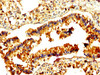 IHC image of CSB-PA019305LA01HU diluted at 1:500 and staining in paraffin-embedded human lung tissue performed on a Leica BondTM system. After dewaxing and hydration, antigen retrieval was mediated by high pressure in a citrate buffer (pH 6.0) . Section was blocked with 10% normal goat serum 30min at RT. Then primary antibody (1% BSA) was incubated at 4°C overnight. The primary is detected by a biotinylated secondary antibody and visualized using an HRP conjugated SP system.
