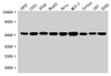 Western Blot<br />
 Positive WB detected in: 293T whole cell lysate, U251 whole cell lysate, A549 whole cell lysate, HepG2 whole cell lysate, Hela whole cell lysate, MCF-7 whole cell lysate, Jurkat whole cell lysate, U87 whole cell lysate, K562 whole cell lysate<br />
 All lanes: SLC25A24 antibody at 1:1500<br />
 Secondary<br />
 Goat polyclonal to rabbit IgG at 1/50000 dilution<br />
 Predicted band size: 54, 52 kDa<br />
 Observed band size: 54 kDa<br />