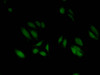Immunofluorescent analysis of Hela cells using CSB-PA010418OA18nacHU at dilution of 1:100 and Alexa Fluor 488-congugated AffiniPure Goat Anti-Rabbit IgG (H+L) Immunofluorescent analysis of Hela cells using CSB-PA010418OA18nacHU at dilution of 1:100 and Alexa Fluor 488-congugated AffiniPure Goat Anti-Rabbit IgG (H+L)
