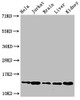 Western Blot<br />
 Positive WB detected in: Hela cell acid extracts, Jurkat cell acid extracts, Mouse brain tissue, Mouse liver tissue, Mouse kidney tissue<br />
 All lanes: HIST1H2BB antibody at 2.5µg/ml<br />
 Secondary<br />
 Goat polyclonal to rabbit IgG at 1/50000 dilution<br />
 Predicted band size: 14 kDa<br />
 Observed band size: 14 kDa<br /> Western Blot<br />
 Positive WB detected in: Hela cell acid extracts, Jurkat cell acid extracts, Mouse brain tissue, Mouse liver tissue, Mouse kidney tissue<br />
 All lanes: HIST1H2BB antibody at 2.5µg/ml<br />
 Secondary<br />
 Goat polyclonal to rabbit IgG at 1/50000 dilution<br />
 Predicted band size: 14 kDa<br />
 Observed band size: 14 kDa<br />