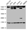 Western Blot<br />
 Positive WB detected in: NIH/3T3 cell acid extracts, Hela cell acid extracts, A549 cell acid extracts, Jurkat cell acid extracts, PC-3 cell acid extracts, HEK293 cell acid extracts<br />
 All lanes: HIST1H3A antibody at 2µg/ml<br />
 Secondary<br />
 Goat polyclonal to rabbit IgG at 1/50000 dilution<br />
 Predicted band size: 16 kDa<br />
 Observed band size: 16 kDa<br />