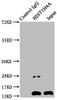 Immunoprecipitating HIST1H4A in Mouse brain tissue<br />
 Lane 1: Rabbit control IgG instead of CSB-PA010429PA12nacHU in Mouse brain tissue.
 For western blotting, a HRP-conjugated Protein G antibody was used as the secondary antibody (1/2000) <br />
 Lane 2: CSB-PA010429PA12nacHU (5µg) + Mouse brain tissue (500µg) <br />
 Lane 3: Mouse brain tissue (20µg) <br />