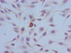 Immunocytochemistry analysis of Hela cells using CSB-PA010418PA10phHU at dilution of 1:100