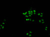 Immunofluorescent analysis of HepG2 cells (sodium butyrate, 30 mM, 4h) using CSB-PA010376PA21acHU at dilution of 1:100 and Alexa Fluor 488-congugated AffiniPure Goat Anti-Rabbit IgG (H+L)