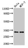 Western Blot<br />
 Positive WB detected in: Hela whole cell lysate, MCF-7 whole cell lysate<br />
 All lanes: HIST1H1B antibody at 1.5µg/ml<br />
 Secondary<br />
 Goat polyclonal to rabbit IgG at 1/50000 dilution<br />
 Predicted band size: 23 kDa<br />
 Observed band size: 32 kDa<br /> Western Blot<br />
 Positive WB detected in: Hela whole cell lysate, MCF-7 whole cell lysate<br />
 All lanes: HIST1H1B antibody at 1.5µg/ml<br />
 Secondary<br />
 Goat polyclonal to rabbit IgG at 1/50000 dilution<br />
 Predicted band size: 23 kDa<br />
 Observed band size: 32 kDa<br />