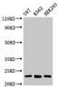 Western Blot<br />
 Positive WB detected in: U87 whole cell lysate, K562 whole cell lysate, HEK293 whole cell lysate<br />
 All lanes: HIST1H1B antibody at 1µg/ml<br />
 Secondary<br />
 Goat polyclonal to rabbit IgG at 1/50000 dilution<br />
 Predicted band size: 23 kDa<br />
 Observed band size: 23 kDa<br />