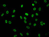 Immunofluorescent analysis of Hela cells (sodium butyrate, 30 mM, 4h) using CSB-PA010378PA16acHU at dilution of 1:100 and Alexa Fluor 488-congugated AffiniPure Goat Anti-Rabbit IgG (H+L)
