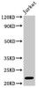 Western Blot<br />
 Positive WB detected in: Jurkat whole cell lysate<br />
 All lanes: HIST1H1C antibody at 1µg/ml<br />
 Secondary<br />
 Goat polyclonal to rabbit IgG at 1/50000 dilution<br />
 Predicted band size: 22 kDa<br />
 Observed band size: 22 kDa<br />