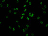 Immunofluorescent analysis of Hela cells (sodium butyrate, 30 mM, 4h) using CSB-PA010100PA11acHU at dilution of 1:100 and Alexa Fluor 488-congugated AffiniPure Goat Anti-Rabbit IgG (H+L)