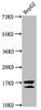 Western Blot<br />
 Positive WB detected in: HepG2 whole cell lysate (treated with 30mM sodium butyrate for 4h) <br />
 All lanes: H2AFZ antibody at 1µg/ml<br />
 Secondary<br />
 Goat polyclonal to rabbit IgG at 1/50000 dilution<br />
 Predicted band size: 14 kDa<br />
 Observed band size: 14 kDa<br />