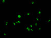 Immunofluorescent analysis of Hela cells using CSB-PA010389PA95forHU at dilution of 1:100 and Alexa Fluor 488-congugated AffiniPure Goat Anti-Rabbit IgG (H+L)