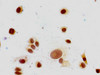 Immunocytochemistry analysis of MCF-7 cells using CSB-PA010380PA147me1HU at dilution of 1:100