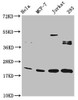 Western Blot<br />
 Positive WB detected in: Hela whole cell lysate, MCF-7 whole cell lysate, Jurkat whole cell lysate, 293 whole cell lysate<br />
 All lanes: HIST1H1C antibody at 1:100<br />
 Secondary<br />
 Goat polyclonal to rabbit IgG at 1/50000 dilution<br />
 Predicted band size: 22 kDa<br />
 Observed band size: 22 kDa<br />