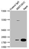 Immunoprecipitating HIST1H1C in 293 whole cell lysate<br />
 Lane 1: Rabbit control IgG instead of CSB-PA010378PA186nme1HU in 293 whole cell lysate.
 For western blotting, a HRP-conjugated Protein G antibody was used as the secondary antibody (1/2000) <br />
 Lane 2: CSB-PA010378PA186nme1HU (5µg) + 293 whole cell lysate (500µg) <br />
 Lane 3: 293 whole cell lysate (20µg) <br />