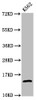 Western Blot<br />
 Positive WB detected in: K562 whole cell lysate (treated by 30mM sodium butyrate for 4h) <br />
 All lanes: H2AFZ antibody at 1.06µg/ml<br />
 Secondary<br />
 Goat polyclonal to rabbit IgG at 1/50000 dilution<br />
 Predicted band size: 14 kDa<br />
 Observed band size: 14 kDa<br />