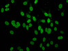 Immunofluorescence staining of Hela cells with CSB-PA010100OA04acHU at 1:10, counter-stained with DAPI. The cells were fixed in 4% formaldehyde, permeabilized using 0.2% Triton X-100 and blocked in 10% normal Goat Serum. The cells were then incubated with the antibody overnight at 4°C. The secondary antibody was Alexa Fluor 488-congugated AffiniPure Goat Anti-Rabbit IgG (H+L) .