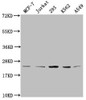 Western Blot<br />
 Positive WB detected in: MCF-7 whole cell lysate, Jurkat whole cell lysate, 293 whole cell lysate, K562 whole cell lysate, A549 whole cell lysate<br />
 All lanes: HIST1H1C antibody at 1:2000<br />
 Secondary<br />
 Goat polyclonal to rabbit IgG at 1/40000 dilution<br />
 Predicted band size: 22 kDa<br />
 Observed band size: 22 kDa<br />