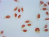 Immunocytochemistry analysis of CSB-PA010389PA118crHU diluted at 1:50 and staining in Hela cells (treated with 30mM sodium crotonylate for 4h) performed on a Leica BondTM system. The cells were fixed in 4% formaldehyde, permeabilized using 0.2% Triton X-100 and blocked with 10% normal goat serum 30min at RT. Then primary antibody (1% BSA) was incubated at 4°C overnight. The primary is detected by a biotinylated secondary antibody and visualized using an HRP conjugated SP system.