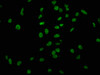 Immunofluorescence staining of Hela cells with CSB-PA010389PA118ncrHU at 1:1, counter-stained with DAPI. The cells were fixed in 4% formaldehyde, permeabilized using 0.2% Triton X-100 and blocked in 10% normal Goat Serum. The cells were then incubated with the antibody overnight at 4°C. The secondary antibody was Alexa Fluor 488-congugated AffiniPure Goat Anti-Rabbit IgG (H+L) .