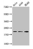 Western Blot<br />
 Positive WB detected in: Hela whole cell lysate, A549 whole cell lysate, HL60 whole cell lysate<br />
 All lanes: HIST1H1C antibody at 1:500<br />
 Secondary<br />
 Goat polyclonal to rabbit IgG at 1/40000 dilution<br />
 Predicted band size: 22 kDa<br />
 Observed band size: 22 kDa<br />