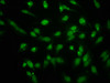 Immunofluorescence staining of Hela cells with CSB-PA010378OA96nhibHU at 1:2.5, counter-stained with DAPI. The cells were fixed in 4% formaldehyde, permeabilized using 0.2% Triton X-100 and blocked in 10% normal Goat Serum. The cells were then incubated with the antibody overnight at 4°C. The secondary antibody was Alexa Fluor 488-congugated AffiniPure Goat Anti-Rabbit IgG (H+L) .