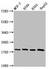 Western Blot<br />
 Positive WB detected in: MCF-7 whole cell lysate, A549 whole cell lysate, K562 whole cell lysate, HepG2 whole cell lysate<br />
 All lanes: HIST1H1C antibody at 1.2µg/ml<br />
 Secondary<br />
 Goat polyclonal to rabbit IgG at 1/50000 dilution<br />
 Predicted band size: 22 kDa<br />
 Observed band size: 22 kDa<br />