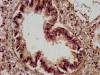 IHC image of CSB-PA001461LA01HU diluted at 1:400 and staining in paraffin-embedded human lung tissue performed on a Leica BondTM system. After dewaxing and hydration, antigen retrieval was mediated by high pressure in a citrate buffer (pH 6.0) . Section was blocked with 10% normal goat serum 30min at RT. Then primary antibody (1% BSA) was incubated at 4°C overnight. The primary is detected by a biotinylated secondary antibody and visualized using an HRP conjugated SP system.