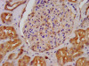 IHC image of CSB-PA001579LA01HU diluted at 1:400 and staining in paraffin-embedded human kidney tissue performed on a Leica BondTM system. After dewaxing and hydration, antigen retrieval was mediated by high pressure in a citrate buffer (pH 6.0) . Section was blocked with 10% normal goat serum 30min at RT. Then primary antibody (1% BSA) was incubated at 4°C overnight. The primary is detected by a biotinylated secondary antibody and visualized using an HRP conjugated SP system.