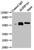 Immunoprecipitating ALDH7A1 in Hela whole cell lysate<br />
 Lane 1: Rabbit control IgG instead of CSB-PA001579LA01HU in Hela whole cell lysate.
 For western blotting, a HRP-conjugated Protein G antibody was used as the secondary antibody (1/2000) <br />
 Lane 2: CSB-PA001579LA01HU (6µg) + Hela whole cell lysate (500µg) <br />
 Lane 3: Hela whole cell lysate (20µg) <br />