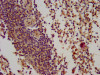 IHC image of CSB-PA002701LA01HU diluted at 1:100 and staining in paraffin-embedded human spleen tissue performed on a Leica BondTM system. After dewaxing and hydration, antigen retrieval was mediated by high pressure in a citrate buffer (pH 6.0) . Section was blocked with 10% normal goat serum 30min at RT. Then primary antibody (1% BSA) was incubated at 4°C overnight. The primary is detected by a biotinylated secondary antibody and visualized using an HRP conjugated SP system.