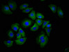 Immunofluorescence staining of A549 cells with CSB-PA010139LA01HU at 1:100, counter-stained with DAPI. The cells were fixed in 4% formaldehyde, permeabilized using 0.2% Triton X-100 and blocked in 10% normal Goat Serum. The cells were then incubated with the antibody overnight at 4°C. The secondary antibody was Alexa Fluor 488-congugated AffiniPure Goat Anti-Rabbit IgG (H+L) .