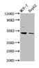 Western Blot<br />
 Positive WB detected in: MCF-7 whole cell lysate, HepG2 whole cell lysate<br />
 All lanes: HEPACAM antibody at 3.2µg/ml<br />
 Secondary<br />
 Goat polyclonal to rabbit IgG at 1/50000 dilution<br />
 Predicted band size: 47, 41 kDa<br />
 Observed band size: 47 kDa<br />