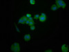 Immunofluorescence staining of MCF-7 cells with CSB-PA010287LA01HU at 1:200, counter-stained with DAPI. The cells were fixed in 4% formaldehyde, permeabilized using 0.2% Triton X-100 and blocked in 10% normal Goat Serum. The cells were then incubated with the antibody overnight at 4°C. The secondary antibody was Alexa Fluor 488-congugated AffiniPure Goat Anti-Rabbit IgG (H+L) .