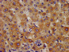 IHC image of CSB-PA010567LA01HU diluted at 1:400 and staining in paraffin-embedded human liver tissue performed on a Leica BondTM system. After dewaxing and hydration, antigen retrieval was mediated by high pressure in a citrate buffer (pH 6.0) . Section was blocked with 10% normal goat serum 30min at RT. Then primary antibody (1% BSA) was incubated at 4°C overnight. The primary is detected by a biotinylated secondary antibody and visualized using an HRP conjugated SP system. IHC image of CSB-PA010567LA01HU diluted at 1:400 and staining in paraffin-embedded human liver tissue performed on a Leica BondTM system. After dewaxing and hydration, antigen retrieval was mediated by high pressure in a citrate buffer (pH 6.0) . Section was blocked with 10% normal goat serum 30min at RT. Then primary antibody (1% BSA) was incubated at 4°C overnight. The primary is detected by a biotinylated secondary antibody and visualized using an HRP conjugated SP system.