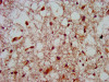 IHC image of CSB-PA010654LA01HU diluted at 1:800 and staining in paraffin-embedded human brain tissue performed on a Leica BondTM system. After dewaxing and hydration, antigen retrieval was mediated by high pressure in a citrate buffer (pH 6.0) . Section was blocked with 10% normal goat serum 30min at RT. Then primary antibody (1% BSA) was incubated at 4°C overnight. The primary is detected by a biotinylated secondary antibody and visualized using an HRP conjugated SP system.