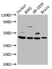 Western Blot<br />
 Positive WB detected in: Jurkat whole cell lysate, K562 whole cell lysate, SH-SY5Y whole cell lysate, Rat brain tissue<br />
 All lanes: HOXD3 antibody at 8.5µg/ml<br />
 Secondary<br />
 Goat polyclonal to rabbit IgG at 1/50000 dilution<br />
 Predicted band size: 46 kDa<br />
 Observed band size: 46 kDa<br /> Western Blot<br />
 Positive WB detected in: Jurkat whole cell lysate, K562 whole cell lysate, SH-SY5Y whole cell lysate, Rat brain tissue<br />
 All lanes: HOXD3 antibody at 8.5µg/ml<br />
 Secondary<br />
 Goat polyclonal to rabbit IgG at 1/50000 dilution<br />
 Predicted band size: 46 kDa<br />
 Observed band size: 46 kDa<br />