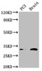 Western Blot<br />
 Positive WB detected in: PC-3 whole cell lysate, Mouse brain tissue<br />
 All lanes: HOXD8 antibody at 4.5µg/ml<br />
 Secondary<br />
 Goat polyclonal to rabbit IgG at 1/50000 dilution<br />
 Predicted band size: 32, 9 kDa<br />
 Observed band size: 32 kDa<br />