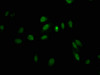 Immunofluorescence staining of Hela cells with CSB-PA012920LA01HU at 1:100, counter-stained with DAPI. The cells were fixed in 4% formaldehyde, permeabilized using 0.2% Triton X-100 and blocked in 10% normal Goat Serum. The cells were then incubated with the antibody overnight at 4°C. The secondary antibody was Alexa Fluor 488-congugated AffiniPure Goat Anti-Rabbit IgG (H+L) .
