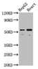 Western Blot<br />
 Positive WB detected in: HepG2 whole cell lysate, Mouse heart tissue<br />
 All lanes: LMAN1 antibody at 5.3µg/ml<br />
 Secondary<br />
 Goat polyclonal to rabbit IgG at 1/50000 dilution<br />
 Predicted band size: 58 kDa<br />
 Observed band size: 58 kDa<br /> Western Blot<br />
 Positive WB detected in: HepG2 whole cell lysate, Mouse heart tissue<br />
 All lanes: LMAN1 antibody at 5.3µg/ml<br />
 Secondary<br />
 Goat polyclonal to rabbit IgG at 1/50000 dilution<br />
 Predicted band size: 58 kDa<br />
 Observed band size: 58 kDa<br />