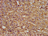 IHC image of CSB-PA012991LA01HU diluted at 1:300 and staining in paraffin-embedded human adrenal gland tissue performed on a Leica BondTM system. After dewaxing and hydration, antigen retrieval was mediated by high pressure in a citrate buffer (pH 6.0) . Section was blocked with 10% normal goat serum 30min at RT. Then primary antibody (1% BSA) was incubated at 4°C overnight. The primary is detected by a biotinylated secondary antibody and visualized using an HRP conjugated SP system. IHC image of CSB-PA012991LA01HU diluted at 1:300 and staining in paraffin-embedded human adrenal gland tissue performed on a Leica BondTM system. After dewaxing and hydration, antigen retrieval was mediated by high pressure in a citrate buffer (pH 6.0) . Section was blocked with 10% normal goat serum 30min at RT. Then primary antibody (1% BSA) was incubated at 4°C overnight. The primary is detected by a biotinylated secondary antibody and visualized using an HRP conjugated SP system.