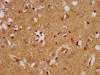 IHC image of CSB-PA013400LA01HU diluted at 1:400 and staining in paraffin-embedded human brain tissue performed on a Leica BondTM system. After dewaxing and hydration, antigen retrieval was mediated by high pressure in a citrate buffer (pH 6.0) . Section was blocked with 10% normal goat serum 30min at RT. Then primary antibody (1% BSA) was incubated at 4°C overnight. The primary is detected by a biotinylated secondary antibody and visualized using an HRP conjugated SP system.