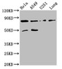 Western Blot<br />
 Positive WB detected in: Hela whole cell lysate, A549 whole cell lysate, U251 whole cell lysate, Mouse lung tissue<br />
 All lanes: Pcsk1 antibody at 8µg/ml<br />
 Secondary<br />
 Goat polyclonal to rabbit IgG at 1/50000 dilution<br />
 Predicted band size: 85 kDa<br />
 Observed band size: 85 kDa<br />