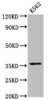 Western Blot<br />
 Positive WB detected in: K562 whole cell lysate<br />
 All lanes: PDLIM4 antibody at 6.1µg/ml<br />
 Secondary<br />
 Goat polyclonal to rabbit IgG at 1/50000 dilution<br />
 Predicted band size: 36, 26 kDa<br />
 Observed band size: 36 kDa<br />