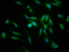 Immunofluorescence staining of Hela cells with CSB-PA018636LA01HU at 1:166, counter-stained with DAPI. The cells were fixed in 4% formaldehyde, permeabilized using 0.2% Triton X-100 and blocked in 10% normal Goat Serum. The cells were then incubated with the antibody overnight at 4°C. The secondary antibody was Alexa Fluor 488-congugated AffiniPure Goat Anti-Rabbit IgG (H+L) .